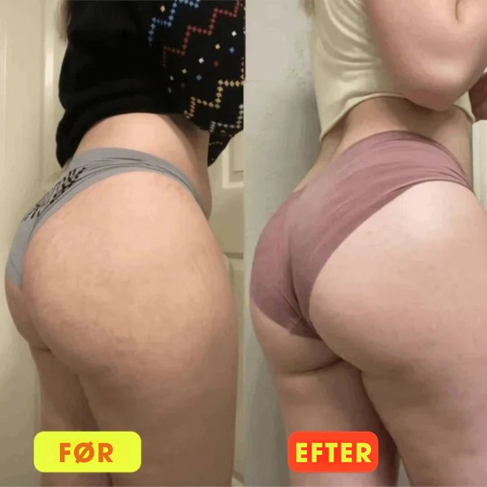 GlutePro™ Max – Trener na jędrniejsze i silniejsze pośladki